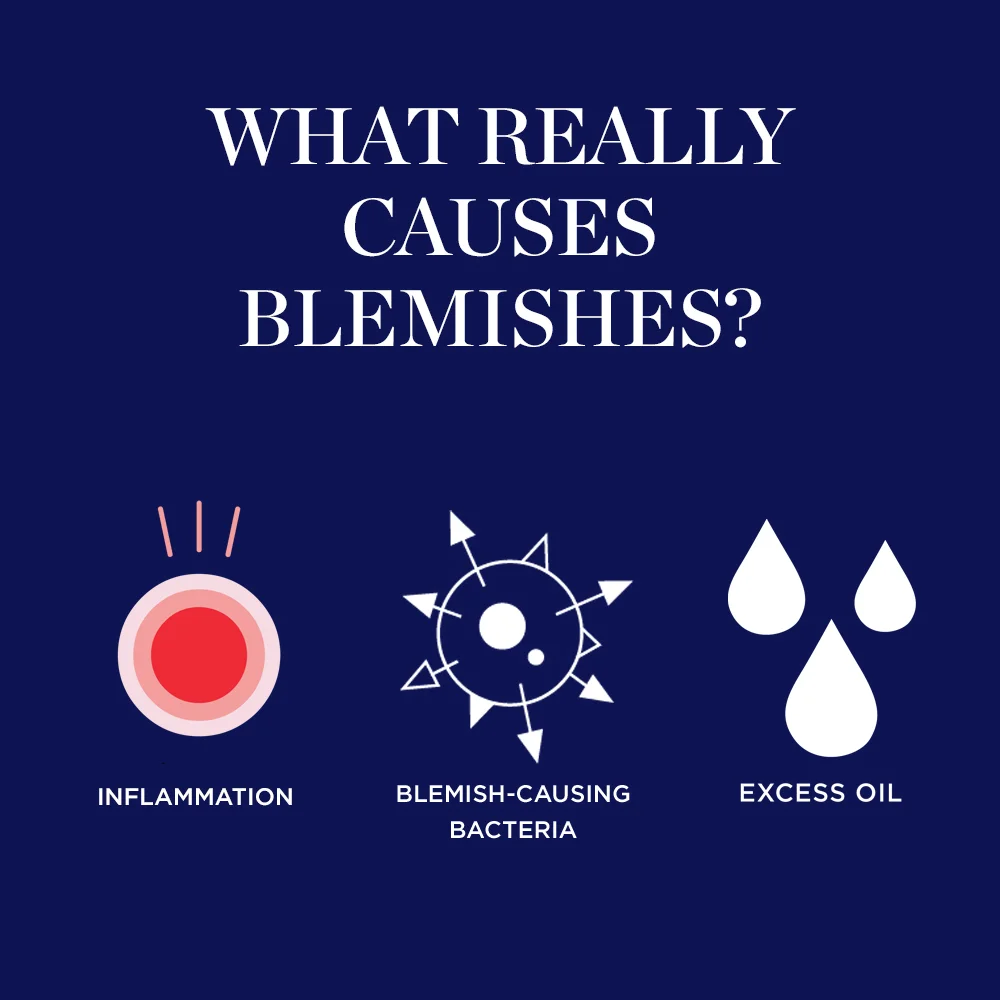 What really causes blemishes? inflammation, blemish-causing bacteria, inflammation, excess oil.